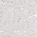 Immunohistochemical staining of human skeletal muscle shows strong nuclear positivity in striated muscle fibers.