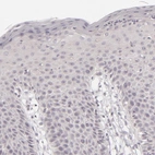 Immunohistochemical staining of human skin shows no nuclear positivity in squamous epithelial cells as expected.
