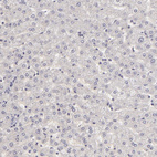 Anti-SIX1 Antibody