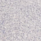 Immunohistochemical staining of human liver shows no nuclear positivity in hepatocytes as expected.