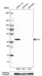 Western blot analysis in Rh30 cells transfected with control siRNA, target specific siRNA probe #1 and #2, using Anti-SIX1 antibody. Remaining relative intensity is presented. Loading control: Anti-PPIB.