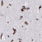 Immunohistochemical staining of human cerebral cortex using Anti-GPKOW antibody HPA001894.