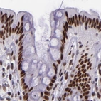 Immunohistochemical staining of human colon using Anti-GPKOW antibody HPA001894.