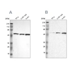 Western blot analysis using Anti-GPKOW antibody HPA001894 (A) shows similar pattern to independent antibody HPA000287 (B).