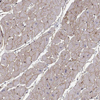 Anti-LAMB2 Antibody