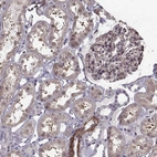 Immunohistochemical staining of human kidney shows weak to moderate membranous positivity in cells in glomeruli.