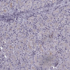 Anti-LAMB2 Antibody