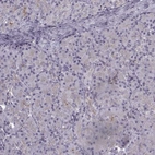 Immunohistochemical staining of human pancreas shows no positivity in exocrine glandular cells as expected.