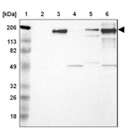 Lane 1: Marker [kDa] 206, 113, 82, 49, 32, 26, 18_br/_Lane 2: Human cell line RT-4_br/_Lane 3: Human cell line U-251MG sp_br/_Lane 4: Human cell line A-431_br/_Lane 5: Human liver tissue_br/_Lane 6: Human tonsil tissue