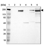 Anti-LAMB2 Antibody