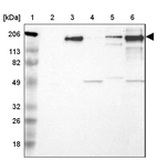 Lane 1: Marker [kDa] 206, 113, 82, 49, 32, 26, 18_br/_Lane 2: Human cell line RT-4_br/_Lane 3: Human cell line U-251MG sp_br/_Lane 4: Human cell line A-431_br/_Lane 5: Human liver tissue_br/_Lane 6: Human tonsil tissue