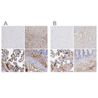 Anti-FGB Antibody