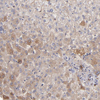 Immunohistochemical staining of human liver shows weak to moderate cytoplasmic positivity in hepatocytes.