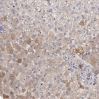 Immunohistochemical staining of human liver shows weak to moderate cytoplasmic positivity in hepatocytes.