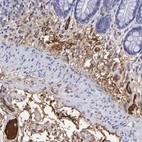 Immunohistochemical staining of human rectum shows strong positivity in plasma in blood vessels, as well as positivity in extracellular matrix.