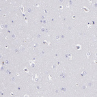 Immunohistochemical staining of human cerebral cortex shows no positivity in neurons as expected.