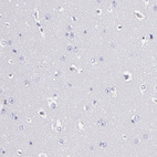 Anti-FGB Antibody