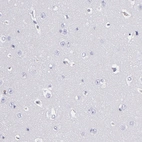Immunohistochemical staining of human cerebral cortex shows no positivity in neurons as expected.