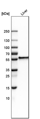 Western blot analysis in human liver tissue.