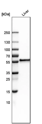 Western blot analysis in human liver tissue.