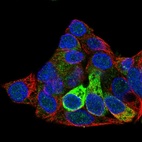 Anti-FGB Antibody