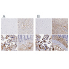 Anti-FGB Antibody