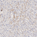 Immunohistochemical staining of human liver shows weak cytoplasmic positivity in hepatocytes.