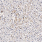 Immunohistochemical staining of human liver shows weak cytoplasmic positivity in hepatocytes.