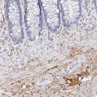 Immunohistochemical staining of human rectum shows moderate positivity in plasma in blood vessels, as well as positivity in extracellular matrix.