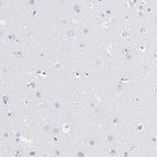 Immunohistochemical staining of human cerebral cortex shows no positivity in neurons as expected.