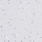 Immunohistochemical staining of human cerebral cortex shows no positivity in neurons as expected.