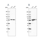 Western blot analysis using Anti-FGB antibody HPA001901 (A) shows similar pattern to independent antibody HPA001900 (B).