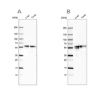 Western blot analysis using Anti-FGB antibody HPA001901 (A) shows similar pattern to independent antibody HPA001900 (B).