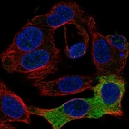 Immunofluorescent staining of human cell line Hep G2 shows localization to endoplasmic reticulum.