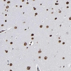Immunohistochemical staining of human cerebral cortex shows moderate nuclear positivity in neurons and glial cells.