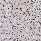 Anti-ATRX Antibody