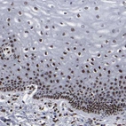 Immunohistochemical staining of human uterine cervix shows moderate to strong nuclear positivity in squamous epithelial cells.