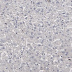 Anti-ATRX Antibody