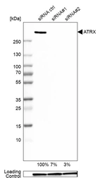 Western blot analysis in A-549 cells transfected with control siRNA, target specific siRNA probe #1 and #2, using Anti-ATRX antibody. Remaining relative intensity is presented. Loading control: Anti-GAPDH.