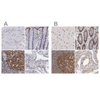 Anti-TERF2 Antibody