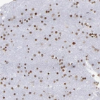 Immunohistochemical staining of human cerebral cortex shows strong nuclear positivity in neurons.