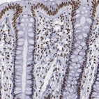 Immunohistochemical staining of human colon shows strong nuclear positivity in glandular cells.