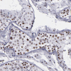 Immunohistochemical staining of human testis shows moderate nuclear positivity in cells in seminiferous ducts.