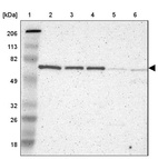 Lane 1: Marker [kDa] 206, 113, 82, 49, 32, 26, 18_br/_Lane 2: Human cell line RT-4_br/_Lane 3: Human cell line U-251MG sp_br/_Lane 4: Human cell line A-431_br/_Lane 5: Human liver tissue_br/_Lane 6: Human tonsil tissue