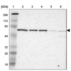 Lane 1: Marker [kDa] 206, 113, 82, 49, 32, 26, 18_br/_Lane 2: Human cell line RT-4_br/_Lane 3: Human cell line U-251MG sp_br/_Lane 4: Human cell line A-431_br/_Lane 5: Human liver tissue_br/_Lane 6: Human tonsil tissue