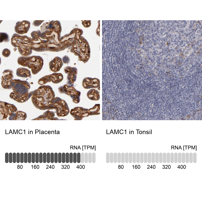Anti-LAMC1 Antibody