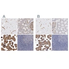 Immunohistochemical staining of human cerebral cortex, kidney, placenta and tonsil using Anti-LAMC1 antibody HPA001908 (A) shows similar protein distribution across tissues to independent antibody HPA001909 (B).