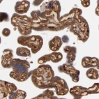 Immunohistochemical staining of human placenta shows strong membranous positivity in trophoblastic cells.