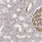 Immunohistochemical staining of human kidney shows strong membranous positivity in cells in glomeruli.