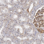 Immunohistochemical staining of human kidney shows strong membranous positivity in cells in glomeruli.